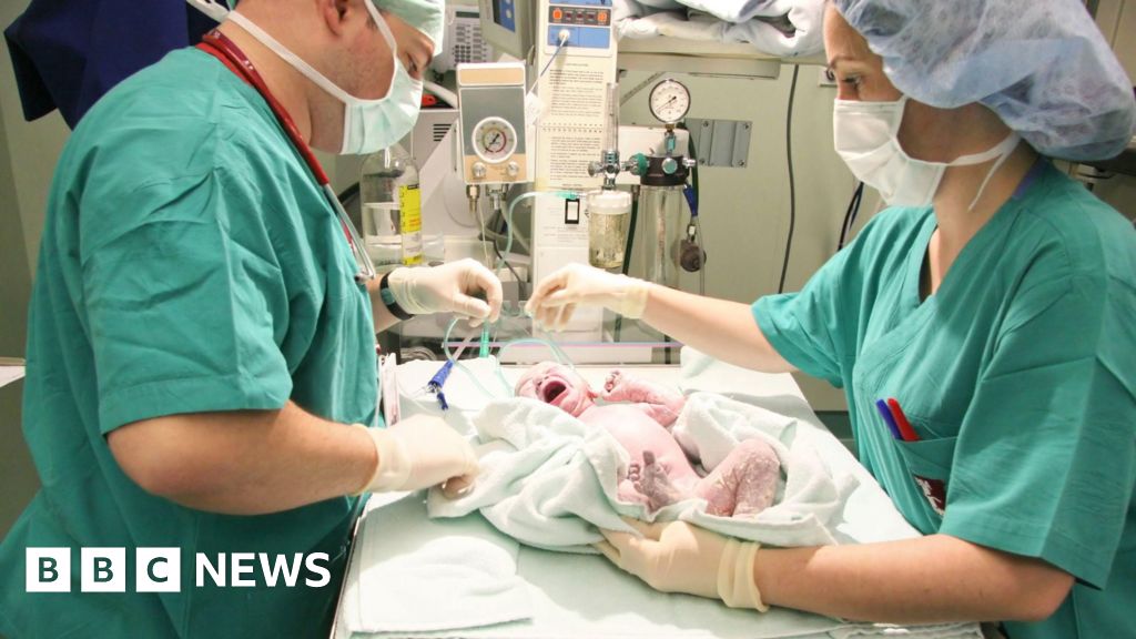 One in four births in England is now emergency caesarean, BBC analysis shows | Noticias Tech y Ciencia Actualizadas